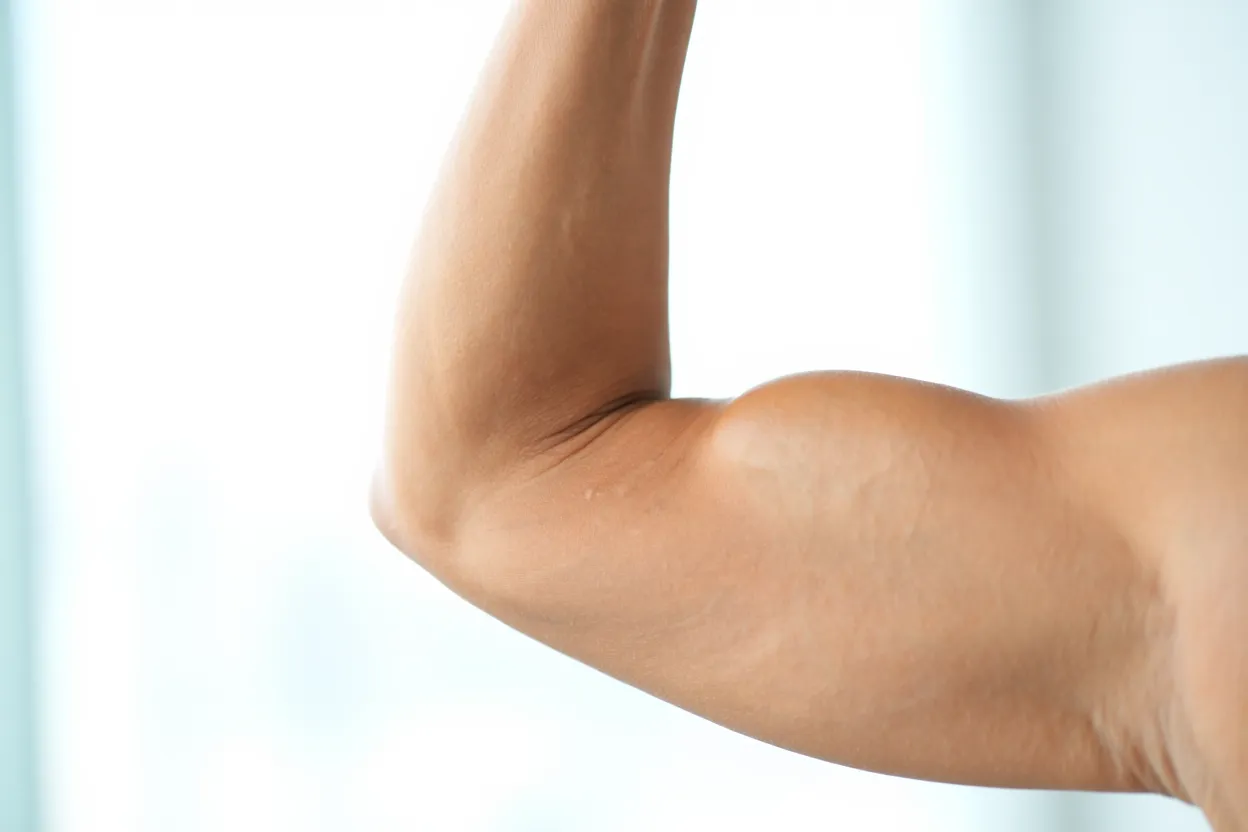 Muscle féminin bras — illustration de l'impact du tirzépatide sur la masse musculaire